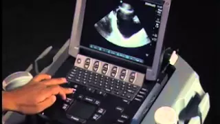 How To: Ultrasound FAST Exam - Male Pelvis