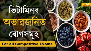 Vitamins and Deficiency Diseases | Important for Competitive Exams