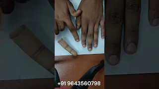 Looking for a Cosmetic Silicone Finger Call us at 9643560798 I Best Cosmetic Silicone Finger Center