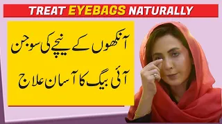 How to Treat Eyebags Problem Naturally | Dr. Umme Raheel