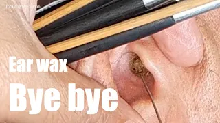 Bye bye earwax discomfort! Welcome total cleaning!