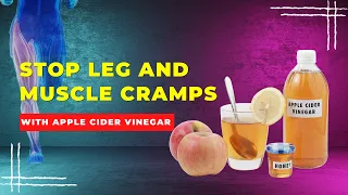 Shocking! How Apple Cider Vinegar Can Eliminate Your Leg Cramps