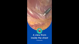 How you visualise inside of the chest