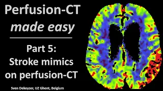 Perfusion CT made easy - part 5 - pitfalls and stroke mimics on perfusion-CT