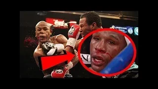 5 Times Floyd Mayweather Almost LOST