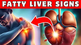 FATTY LIVER Disease: 8 Silent Threats You Must Know About