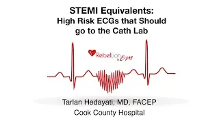 STEMI Equivalents - Tarlan Hedayati, MD