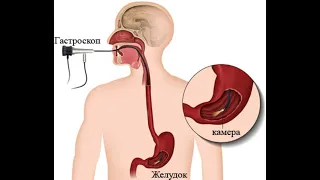 ФГДС это безболезненно или обзор на мой визит на эту процедуру 2021!
