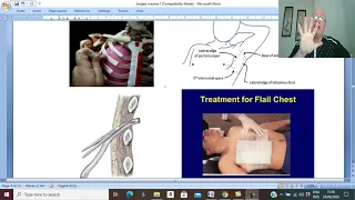 Trauma in Arabic 3 (Primary survey , breathing ) , by Dr. Wahdan