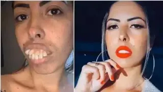 Woman's Amazing Teeth 'Transformation' Gets Millions Of Views, But People Spot A Problem |Jaqueline