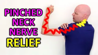 The Best Exercise To Fix A Pinched Nerve Causing Neck & Arm Pain