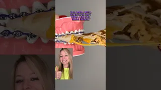 BEST FOODS TO EAT WITH BRACES FROM TACO BELL 🦷 ORTHODONTIST REACTS ASMR CRUNCHY TEETH