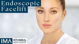 Endoscopic Facelift - Istanbul Med Assist