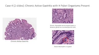 LG05 Stomach Pathology Slide Review 25 min