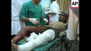 Wounded Palestinians from airstrike