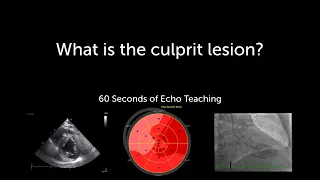 What is the culprit lesion?