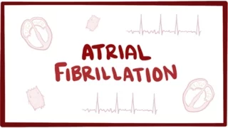Atrial fibrillation (A-fib, AF) - causes, symptoms, treatment & pathology
