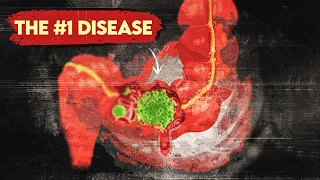 The #1 Disease More Common than Heart Disease and Cancer