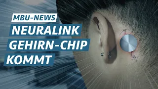 Neuralink startet Menschen-Experimente | MBU News