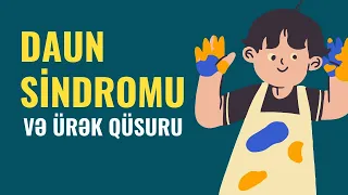 DAUN SİNDROMLU uşaqlarda ÜRƏK QÜSURU OLUR? |  Elnur İmanov