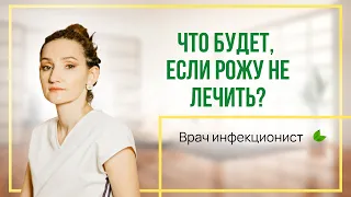 Что будет, если рожу не лечить?  Врач инфекционист