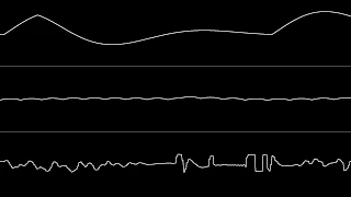 MultiStyle Labs - "Modern Love Classics" (C64) [Oscilloscope View]