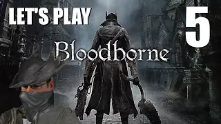 Part 5 - Bloodborne - Fear The Old Blood (BOSS: Vicar Amelia)