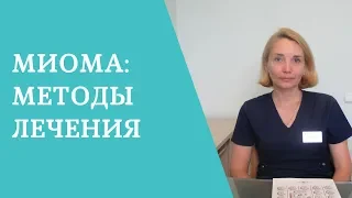 Миома матки: современные методы лечения