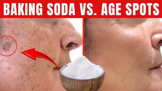 BAKING SODA premanently remove AGE SKIN SPOTS! Do this...