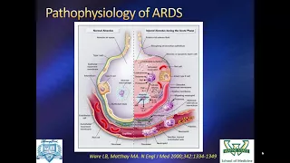Ventilatory Management of ARDS