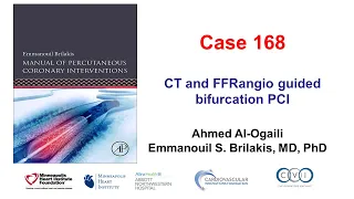 Case 168: Manual of PCI - CT and FFRangio guided PCI