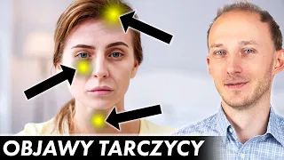 17 oznak, że Twoja tarczyca woła o pomoc! Niedoczynność tarczycy: objawy | Dr Bartek Kulczyński