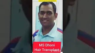 Ms Dhoni ka Hair Transplant || Cricket History ka Sabse Tez Dimag Wala Player