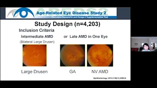 Age-Related Macular Degeneration by Emily Y. Chew, MD - UCI CTVR