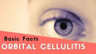 Orbital Cellulitis - Basic Facts