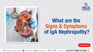 IgA Nephropathy Signs & Symptoms | What are the Signs & Symptoms of IgA Nephropathy? | #iga