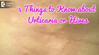 Tips to identify Urticaria. Complications & best Treatment-Dr. Amrita Hongal Gejje | Doctors' Circle