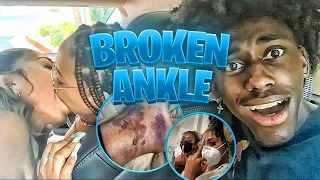 Keisha Koxx Broke Her Ankle On Easter