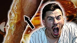 100 LAYERS OF WAX CHALLENGE!! *EXTREME PAIN*