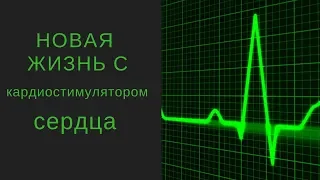 Кардиостимулятор. часть 1