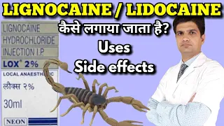 Lidocain injection | Lignocain injection | Lox 2% injection | xylocaine injection uses, side effects