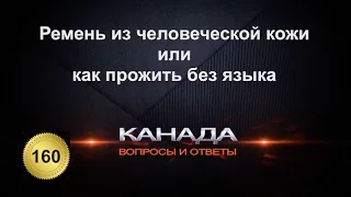 160. Ремень из человеческой кожи, или как прожить без английского языка в Канаде и США