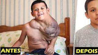 TRANSFORMAÇÃO total: Menino REMOVE TUMOR NO PESCOÇO e poderá REALIZAR seu SONHO!