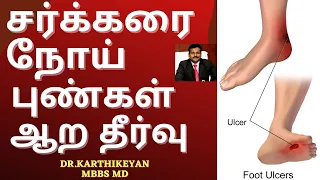 Foot Ulcer in Diabetes how to control in tamil | Doctor Karthikeyan