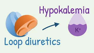 How diuretics cause hypokalemia