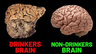 How Alcohol Affects The Human Brain (SCIENCE EXPLAINED)