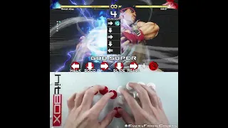 God Super - #EveryFrameCounts #HowToHitBox #スト5  #HitBox #SFV #StreetFighterV