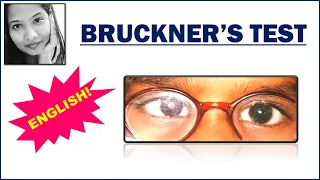 Bruckner's Test (English) | Squint simplified | Paediatric Ophthalmology