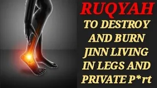 POWERFUL RUQYAH TO DESTROY AND BURN JINN LIVING IN LEGS AND PRIVATE P*rt .