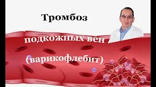 Лечить тромбофлебит поверхностных вен. Знания для ВСЕХ.